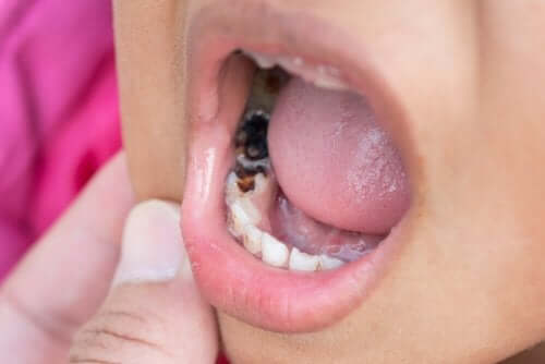 A child's mouth.