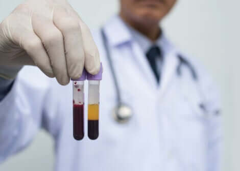 A doctor holding vials of blood.