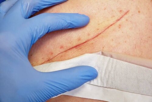 A doctor looking at a wound.