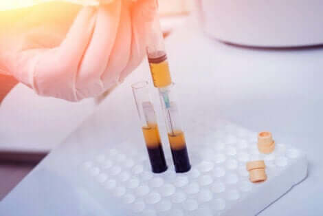 A doctor separating blood.