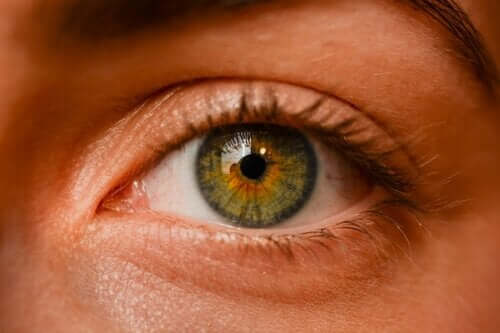 Ocular Nevi - Are Eye Freckles Dangerous?