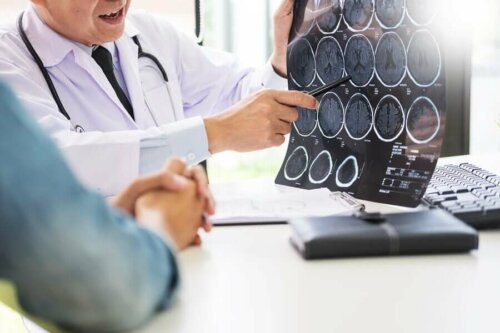 Doctor explaining a brain scan to a patient.