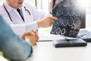Neurogluten: Gluten and Neurological Diseases