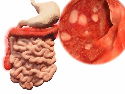 A graphic showing intestines and an infection that can occur if you eat food that has fallen on the ground.