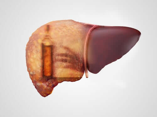 Alcoholic Hepatitis: Symptoms, Causes, And Treatments - Step To Health