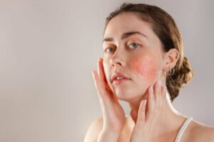 Reactive Skin: Symptoms, Causes, and Treatment