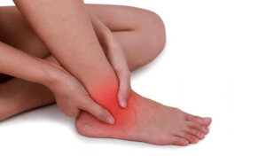 Natural Remedies to Relieve a Sprained Ankle