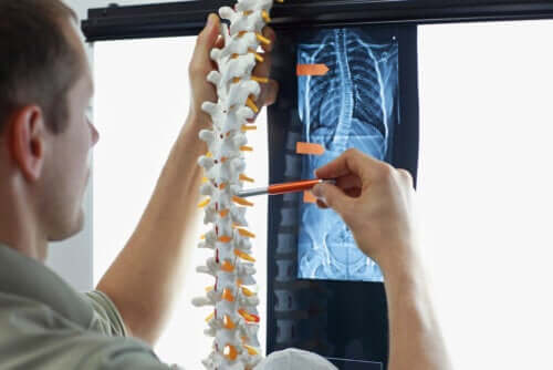 Exercises for Scoliosis of the Spine