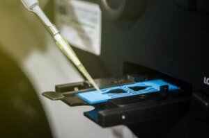 How to Interpret the Results of a Spermogram