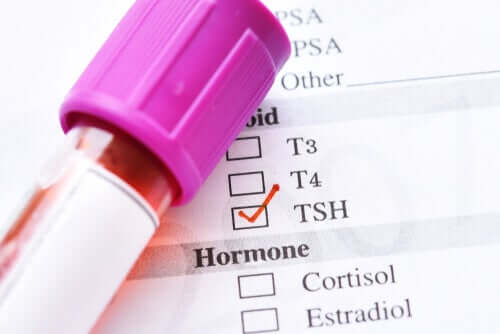 The Causes of Low Thyroid Stimulating Hormone