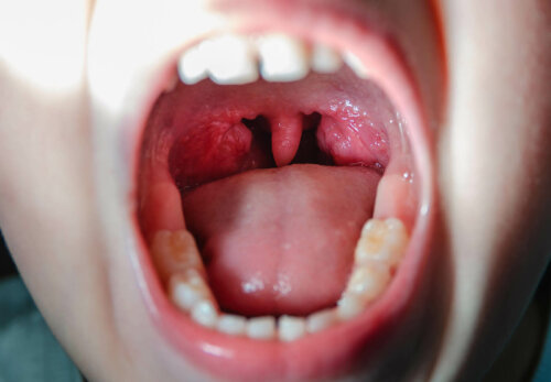 An open mouth.