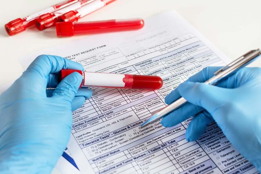 A doctor analyzing blood tests.