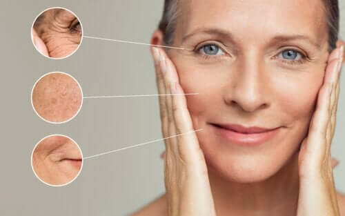Different Types of Wrinkles