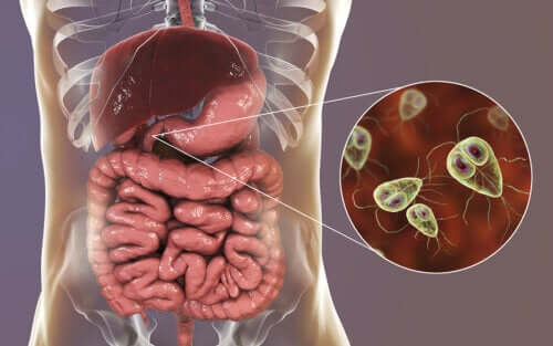 The Symptoms and Treatment of Giardiasis