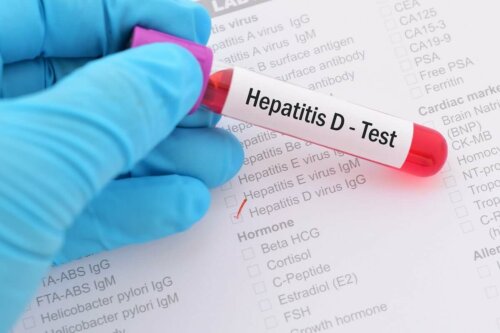 Hepatitis D test.