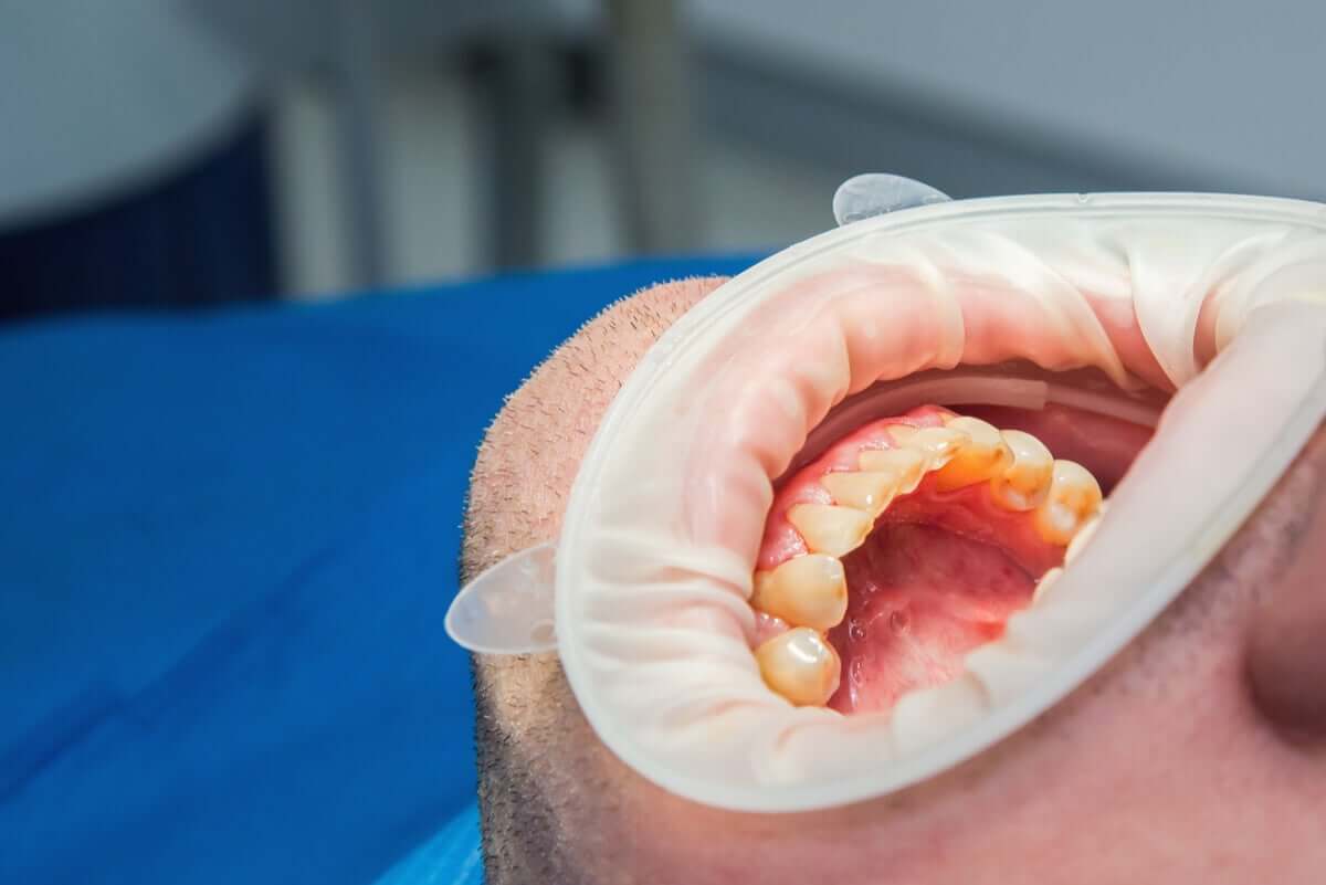 A man at the dentist.