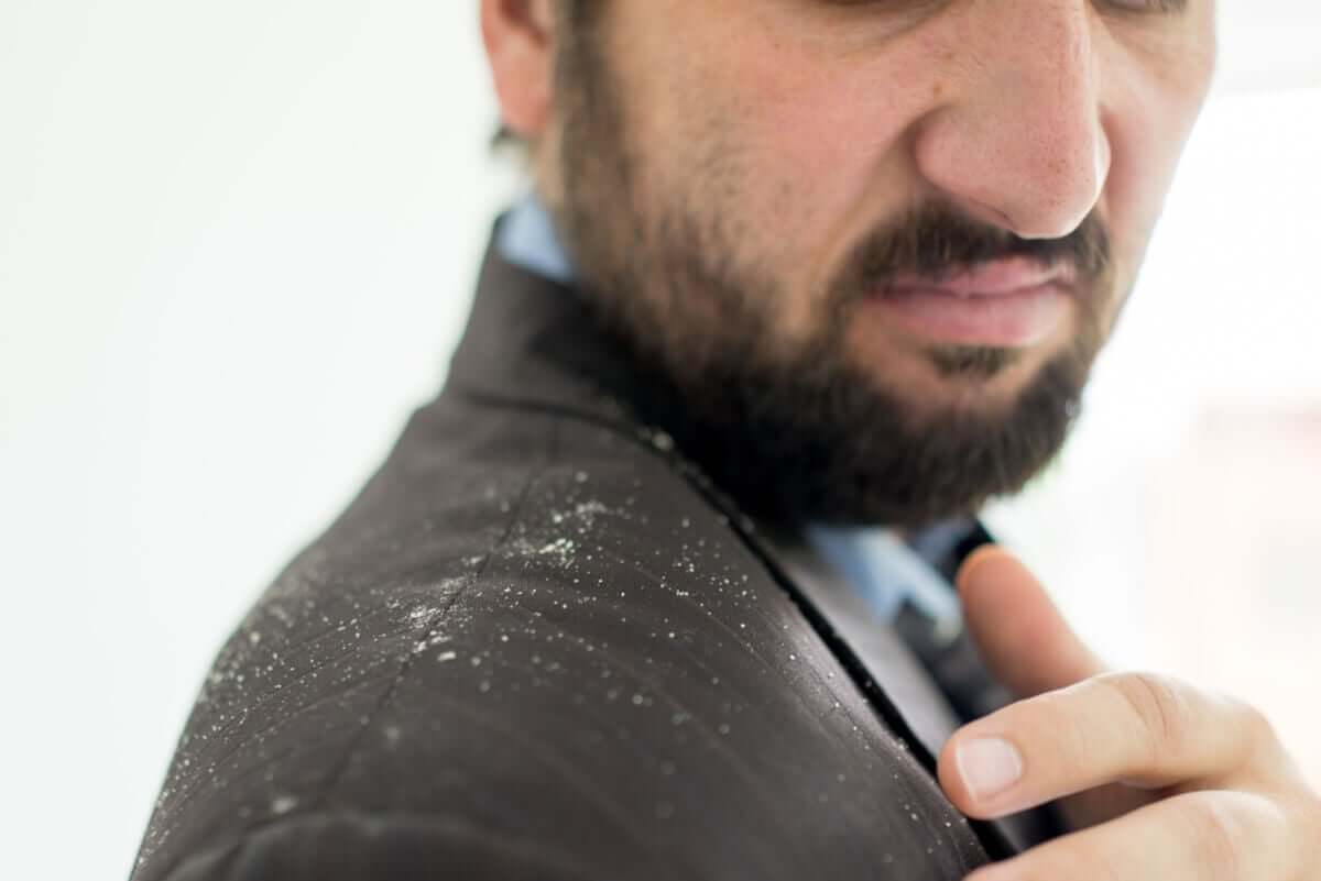 A man with dandruff.