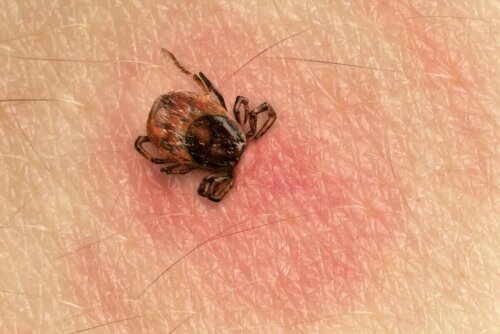 A tick on the skin.