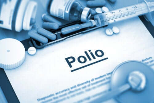 Types of Poliomyelitis