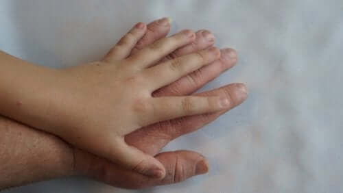 The Treatment and Symptoms of Acromegaly
