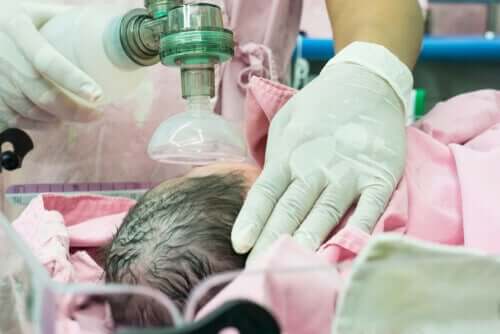 A baby receiving oxygen.