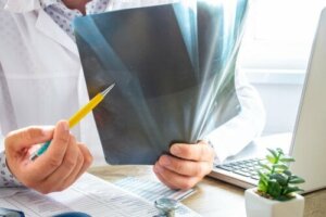 Bone Marrow Edema: All You Need to Know