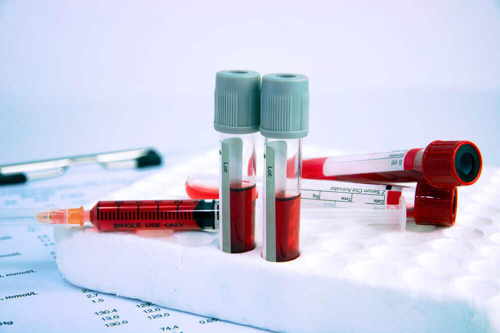 Blood in test tubes and syringes.