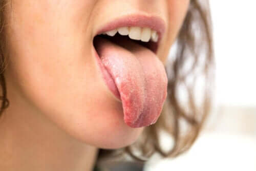 Why Do People with Diabetes Experience Dry Mouth?