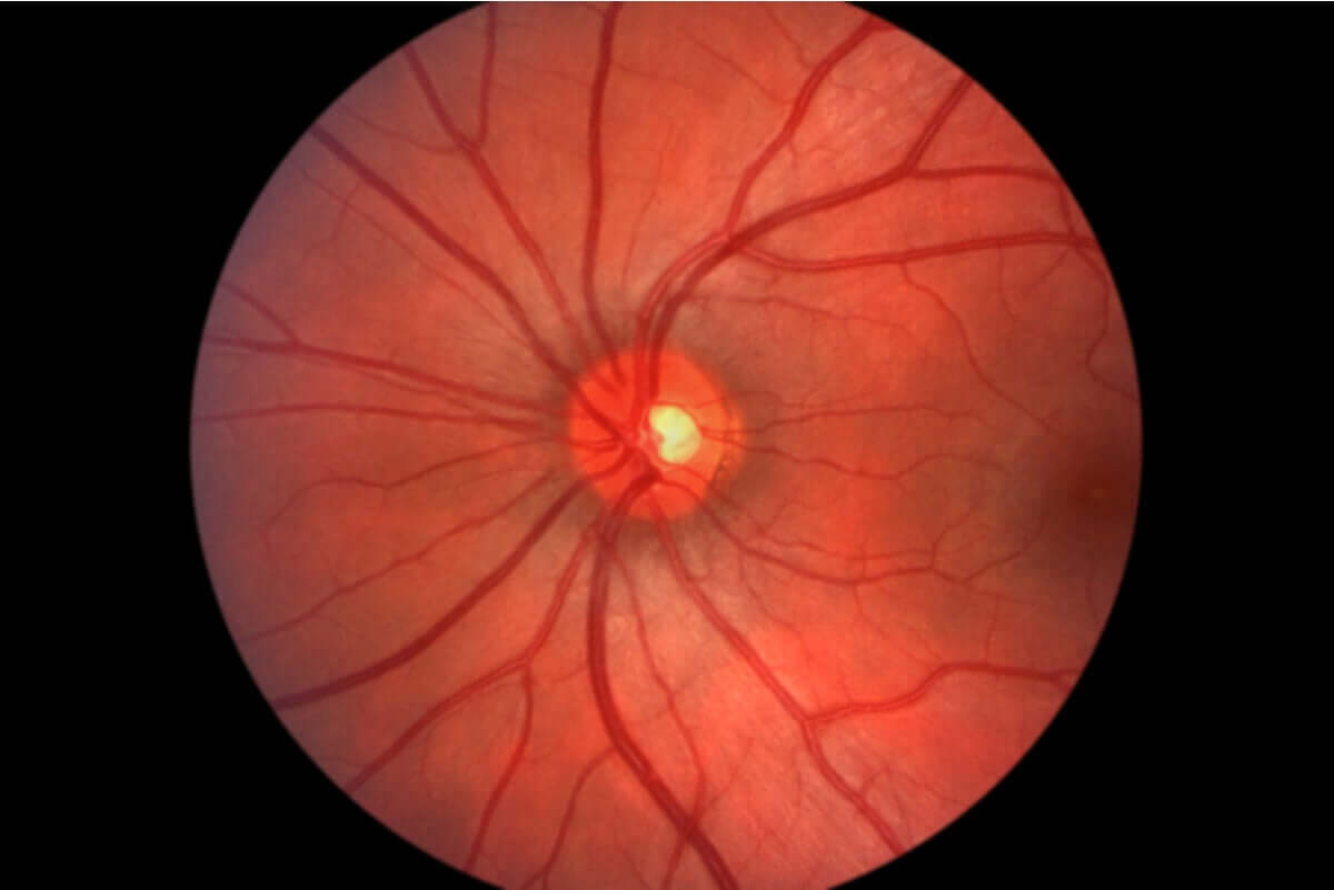 The fundus of the eye.