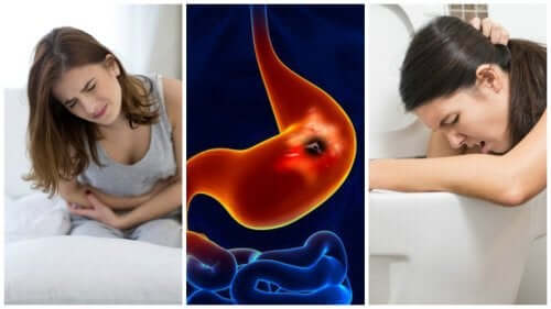 Stomach ulcer symptoms.
