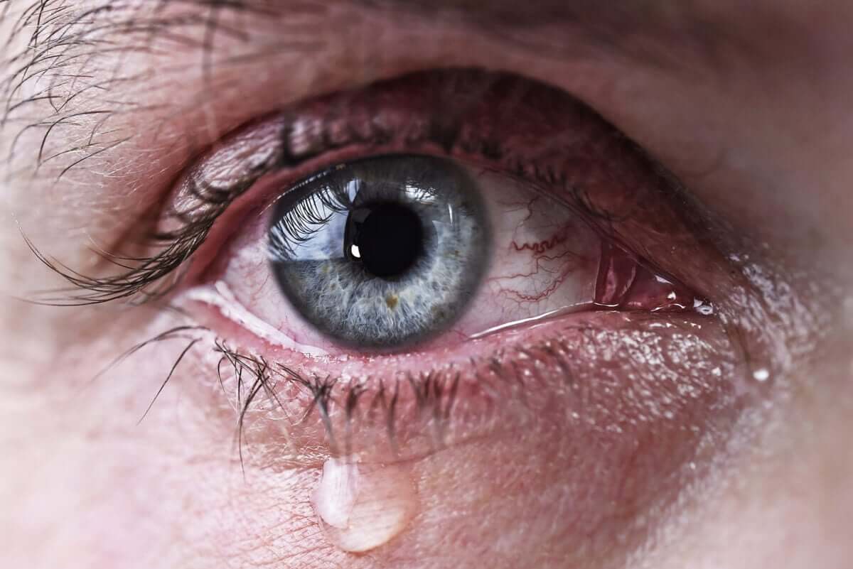 watery-eyes-causes-symptoms-and-remedies-healthkart