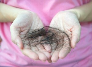 What Do You Know About Postpartum Alopecia?