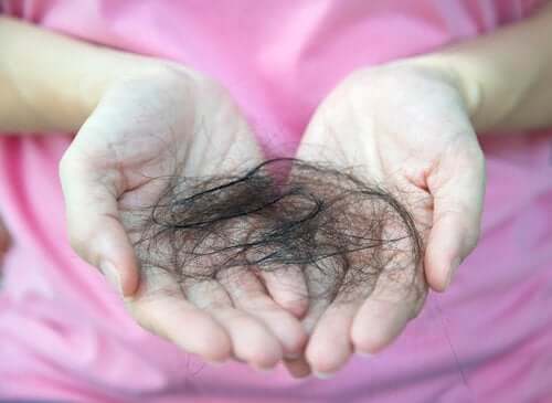 What Do You Know About Postpartum Alopecia?