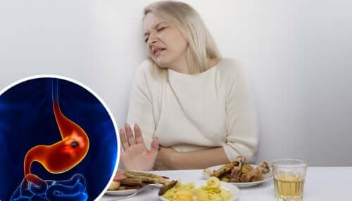 A woman with a peptic ulcer.