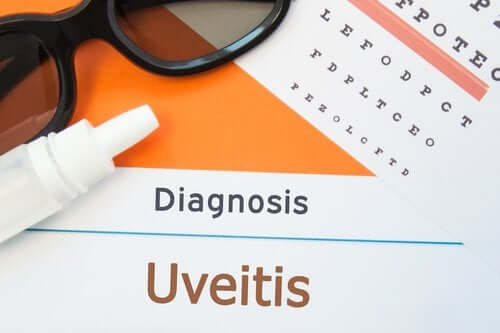 What Are Symptoms of Uveitis?