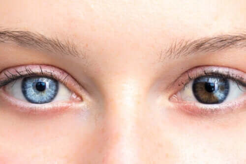 Changes in Eye Color Can Be Cause for Concern