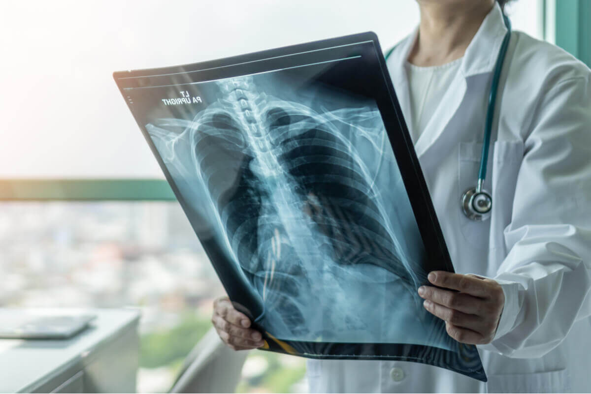 A female doctor looking at a lung x-ray.
