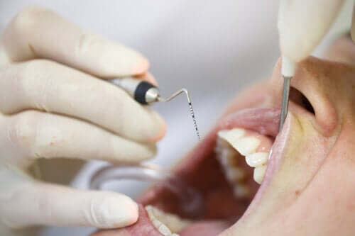 Pyorrhea: A Problematic Gum Disease