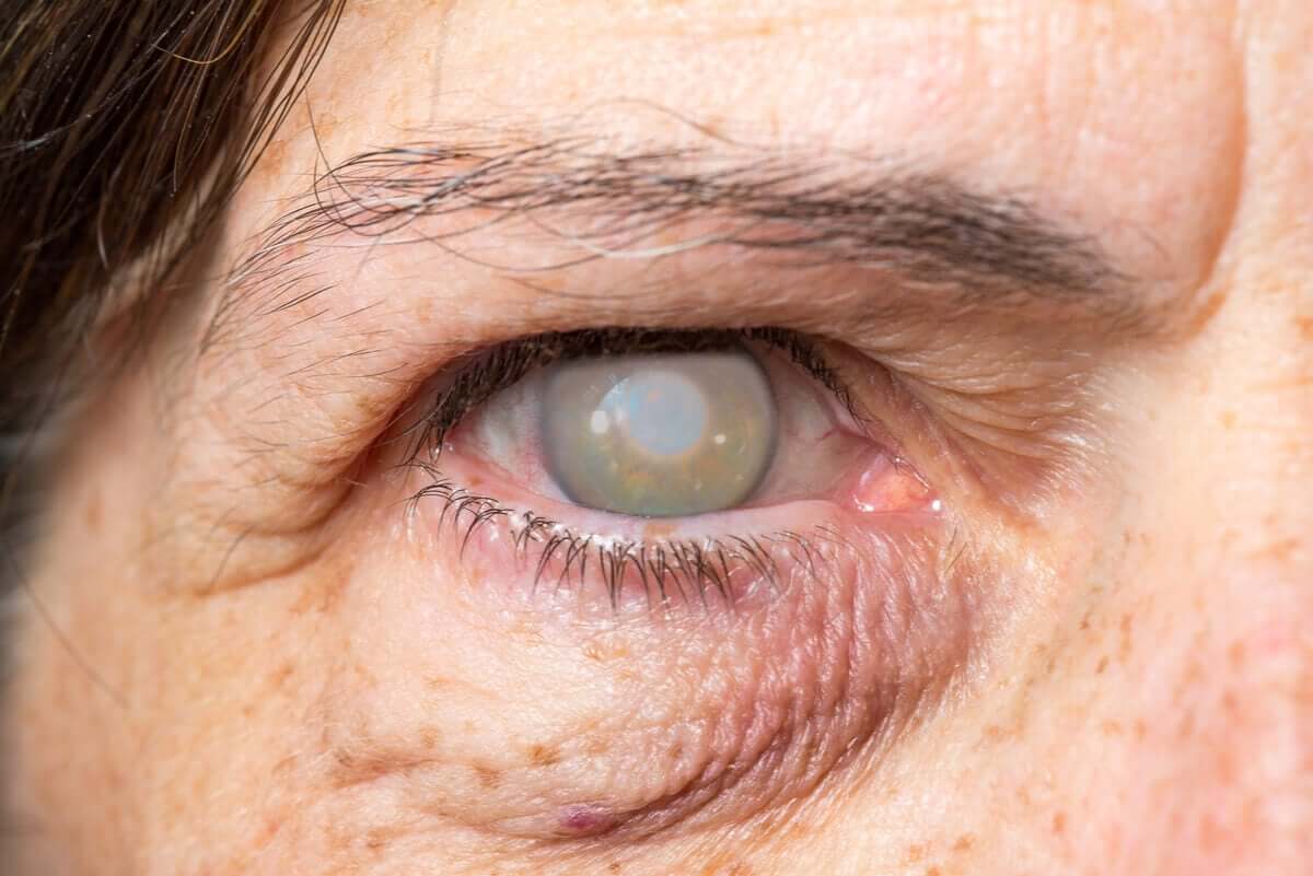 A blind woman.