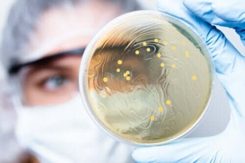 What Are Stool Cultures?