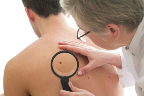 A man getting his dermatofibroma checked out by a dermatologist.