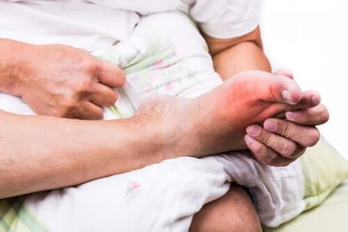 A person with gout.