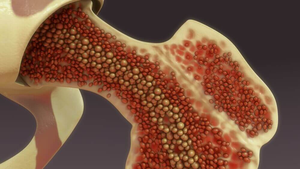 A digital image of bone marrow.