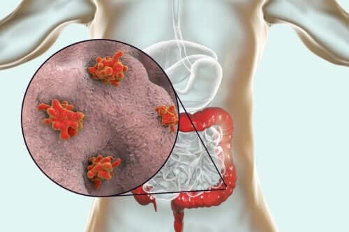 Diseases Caused by Protozoa