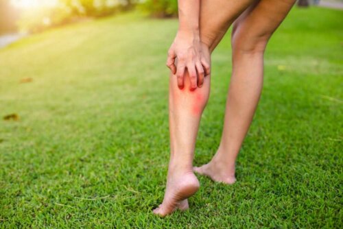 An itchy leg.