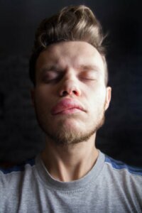 The Causes and Symptoms of Hereditary Angioedema