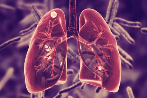What is Pulmonary Tuberculosis and What Are Its Symptoms?