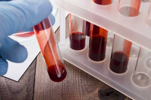A test tube with blood.