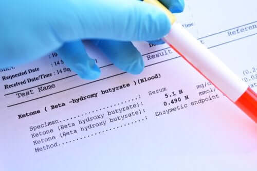 A blood test indicating acidosis.