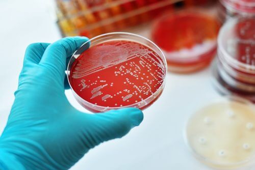 A lab technician doing a Sporotrichosis culture.